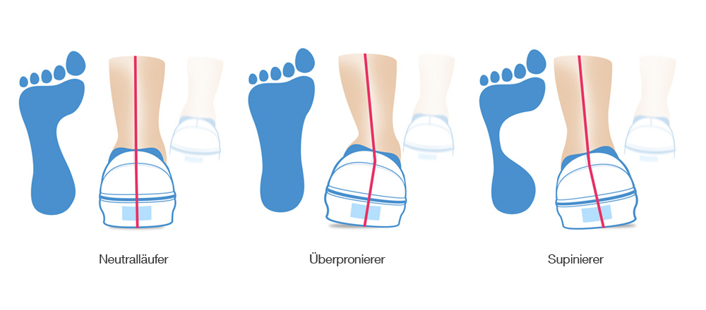 Pronation, Supination und Neutral